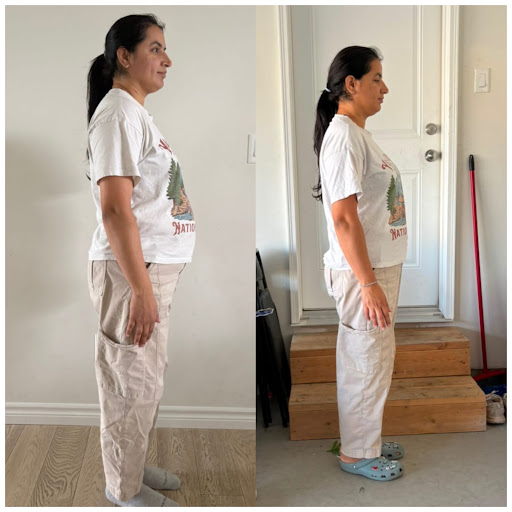 Shalini transformation